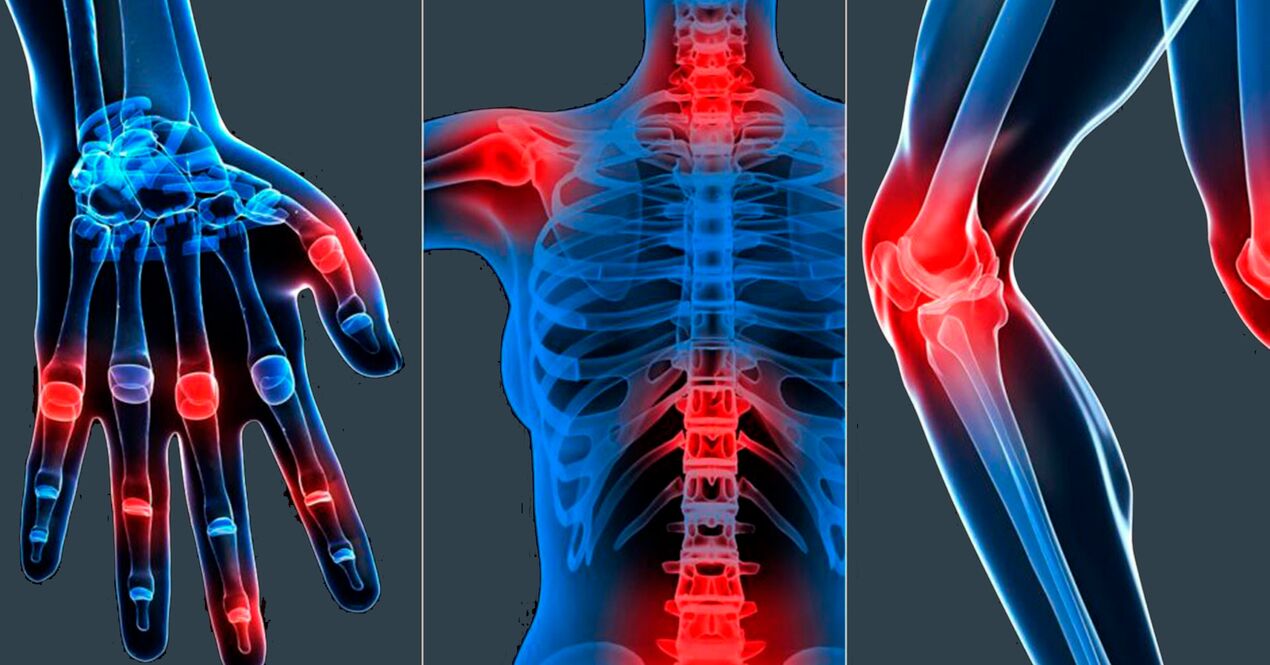 Indicaciones de uso del extracto de Boswellia en cápsulas.