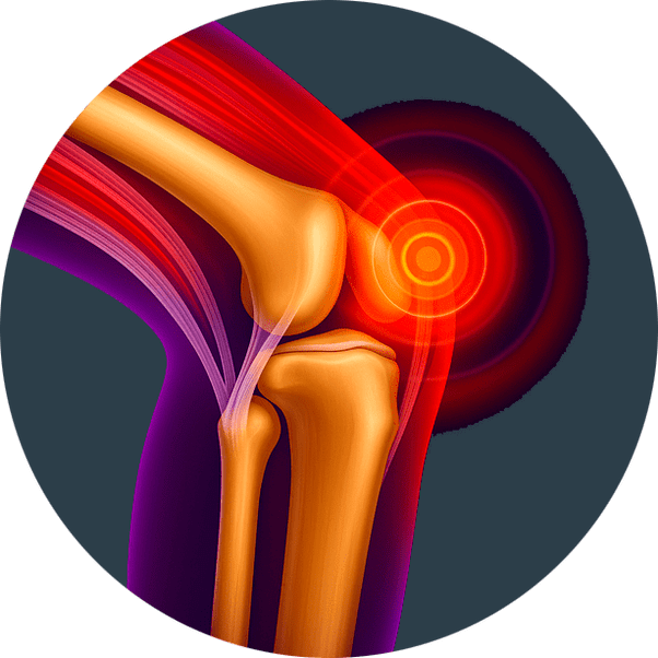 Inflamación de las articulaciones